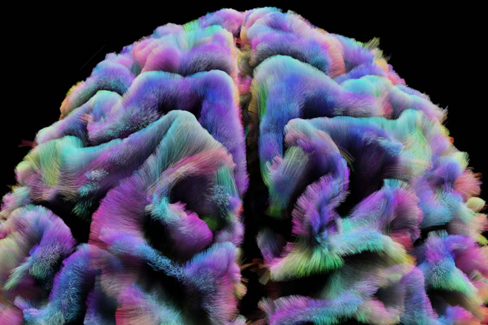 A colorful view of a brain scan.