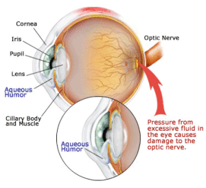 eye-diagram