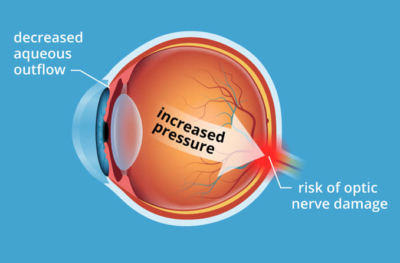 The International Eye Hospital on X: Important to make regular clinical  appointments for a healthy vision.  / X