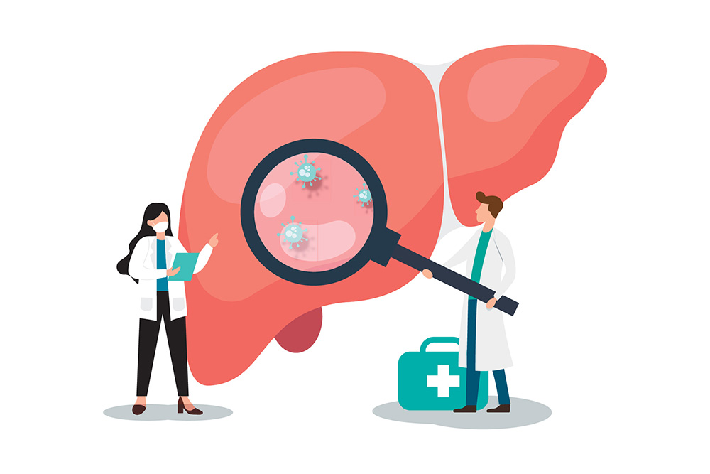 A digital graphic of two medical professionals examining a large liver with a magnifying glass and finding three spots indicating disease