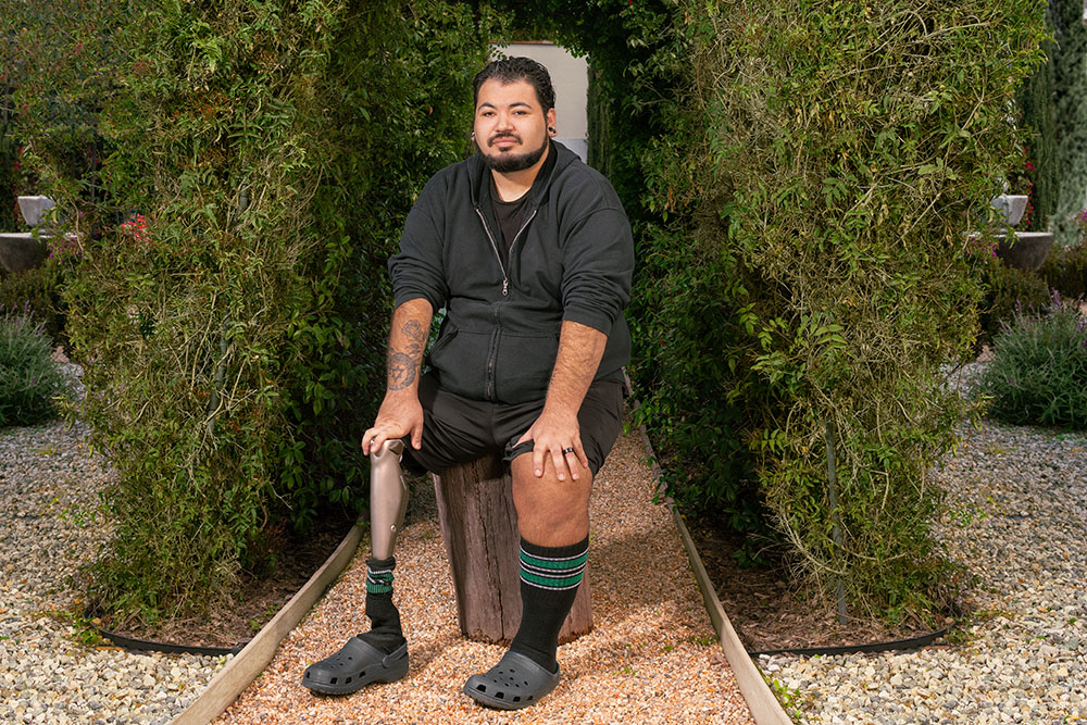 Osseointegration patient Robert Johnson sits on a log with hands on both knees