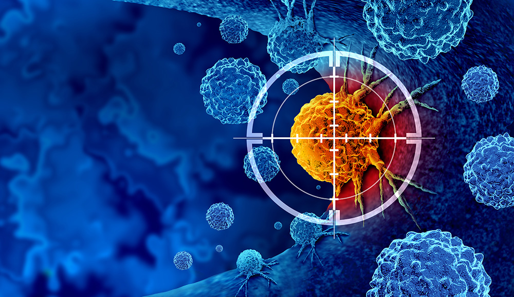 Neoadjuvant Use Shows New Promise for Immunotherapy in Head and Neck Cancer
