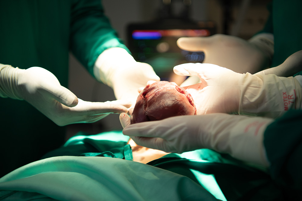 A surgeon hands off a donated heart kept viable through recent changes in the field of heart transplant.