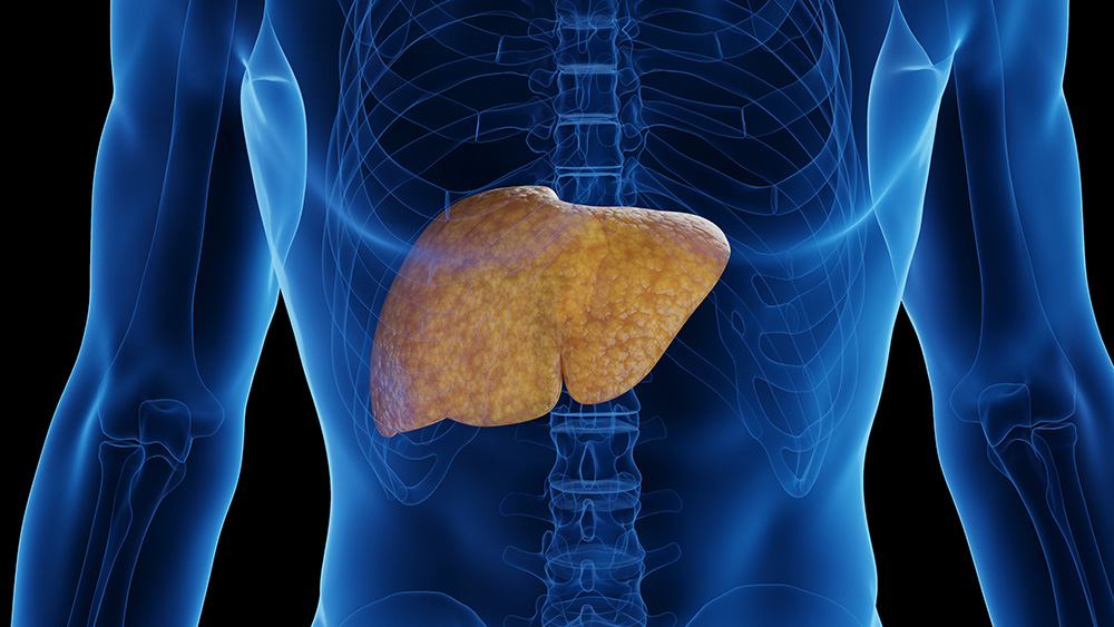 Illustration of fatty liver in human body.