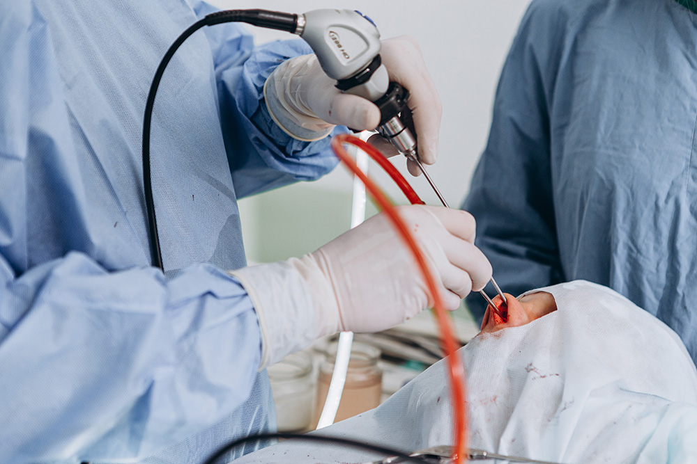 Surgeons performing endoscopic sinus surgery on patient in OR.